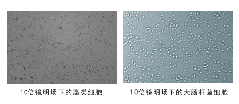 細(xì)胞計數(shù)儀鏡頭下的細(xì)胞圖片 細(xì)胞計數(shù)儀鏡頭下的細(xì)胞圖片